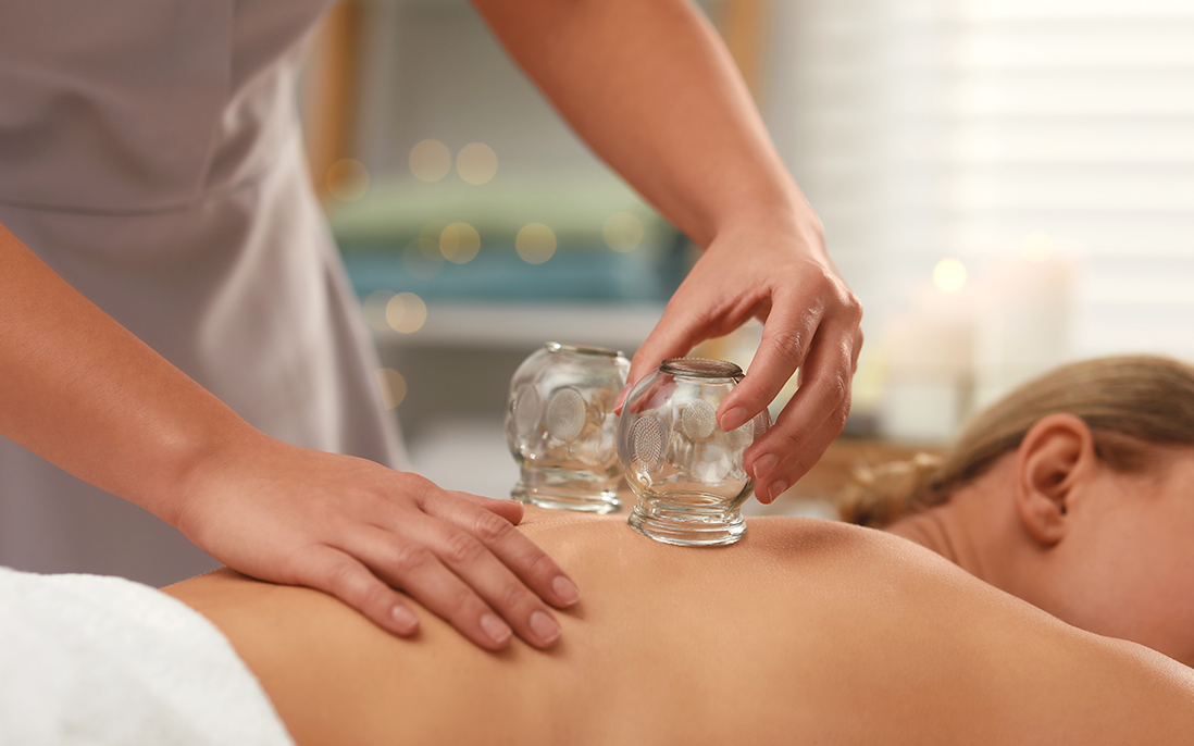 Cupping Therapy at The Milo Clinic